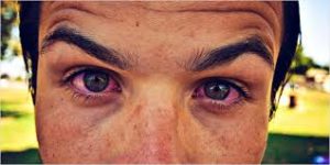 Dlaczego marihuana powoduje czerwone oczy?, GrubyLoL.com